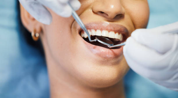 Best Broken or Cracked Tooth Emergency Dentist in Lebanon, OH
