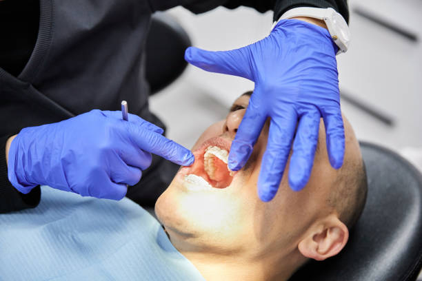 Best Emergency Dental Extractions in Lebanon, OH